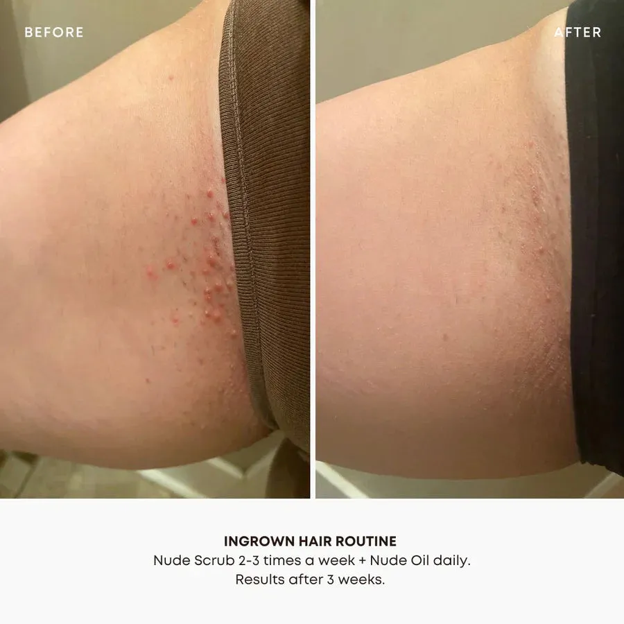 Bushbalm Nude Ingrown Hair Exfoliating Scrub (8 oz)
